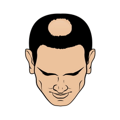 Stage 3