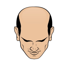 Stage 6