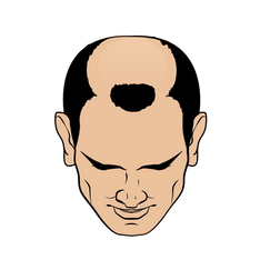 Stage 4