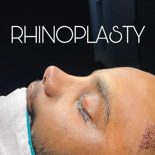 Asian Rhinoplasty,Asian Rhinoplaty Turkey