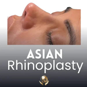 Asian Rhinoplasty