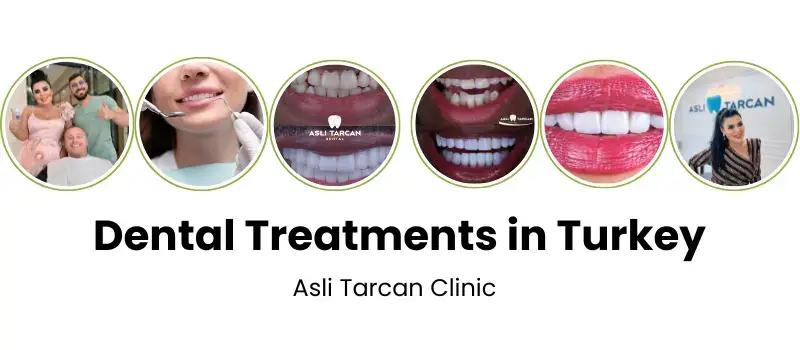 Dental treatments in turkey