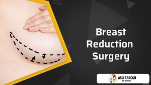 breast-reduction-surgery