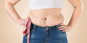 Cencal Cover Weightloss Surgery