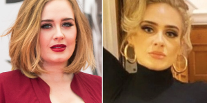 Did Adele Get Weightloss Surgery?