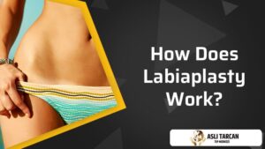 How Does Labiaplasty Work?