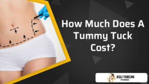 How Much Does A Tummy Tuck Cost?