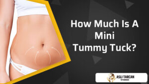 How Much Is A Mini Tummy Tuck?