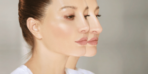 How Much Is A Rhinoplasty?