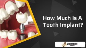 how-much-is-a-tooth-implant