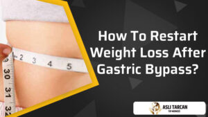 How To Restart Weight Loss After Gastric Bypass?