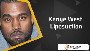 kanye-west-liposuction