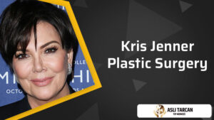 Kris Jenner Plastic Surgery