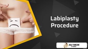 labiplasty-procedure