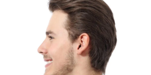 Male Rhinoplasty