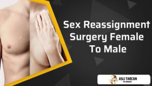 Sex Reassignment Surgery Female To Male