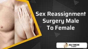 Sex Reassignment Surgery Male To Female