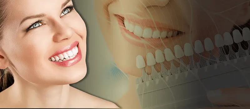 teeth whitening in turkey,teeth whitening turkey