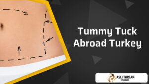 Tummy Tuck Abroad Turkey