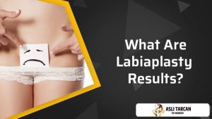 what-are-labiaplasty-results