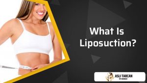 what-is-liposuction