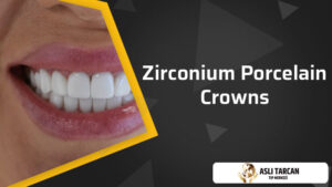 Zirconium Porcelain Crowns