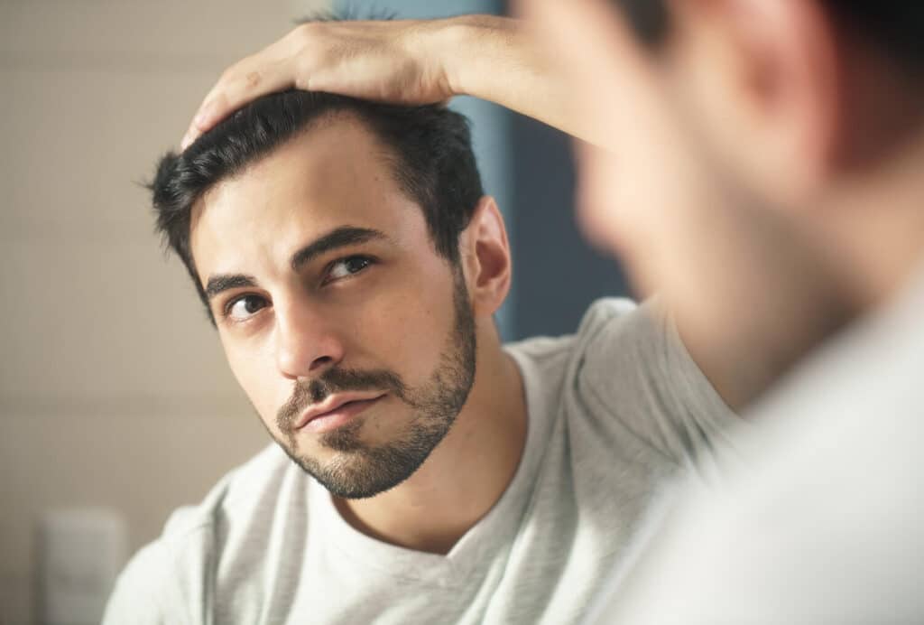 Man examining his hairline in a mirror after a Sapphire FUE hair transplant, showing natural-looking hair density and a restored frontal hairline.