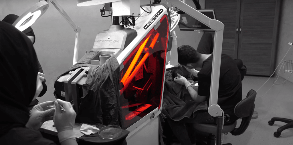 Robotic DHI Hair Transplantation Technique in Turkey Istanbul by Asli Tarcan Clinic