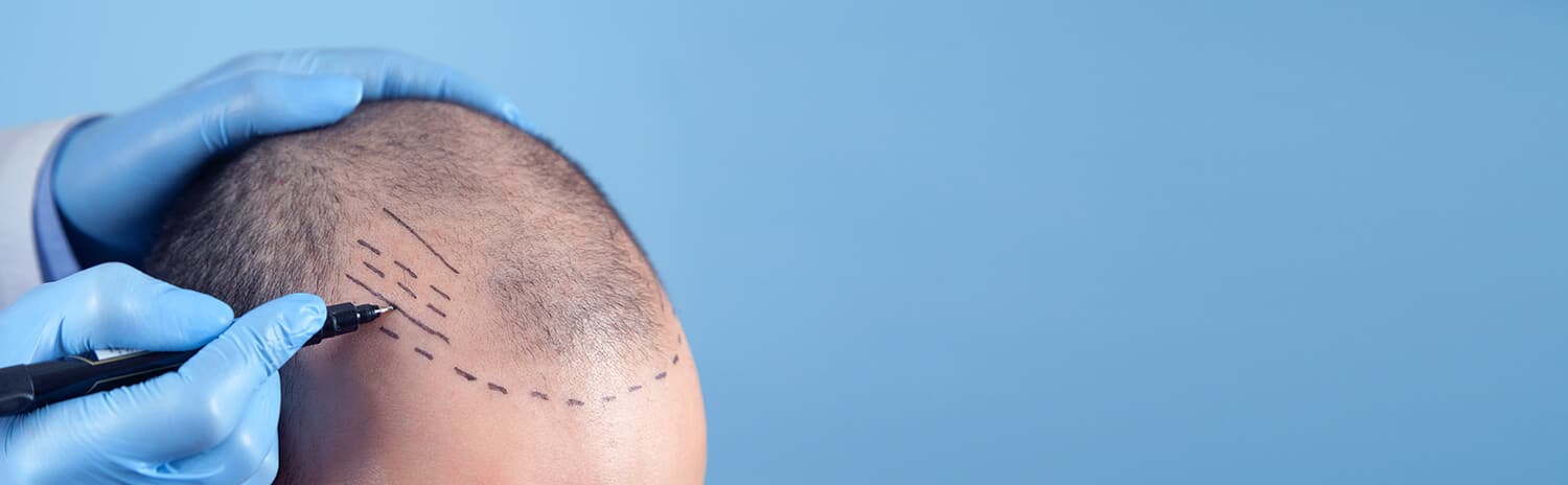 The Advantages of the DHI Method