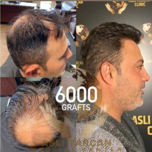 Before and After image