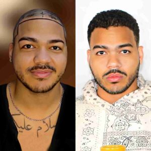 Before and After picture