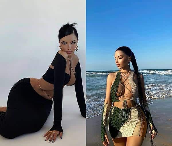 beren güney Hair Transplant