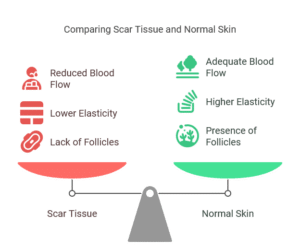 Comparing Scar Tissue and Normal Skin