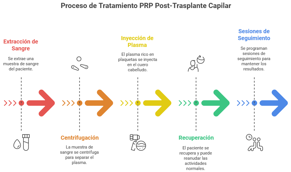 Ilustración del proceso de tratamiento PRP aplicado en el cuero cabelludo tras un trasplante capilar, mostrando la inyección de plasma rico en plaquetas para estimular el crecimiento del cabello