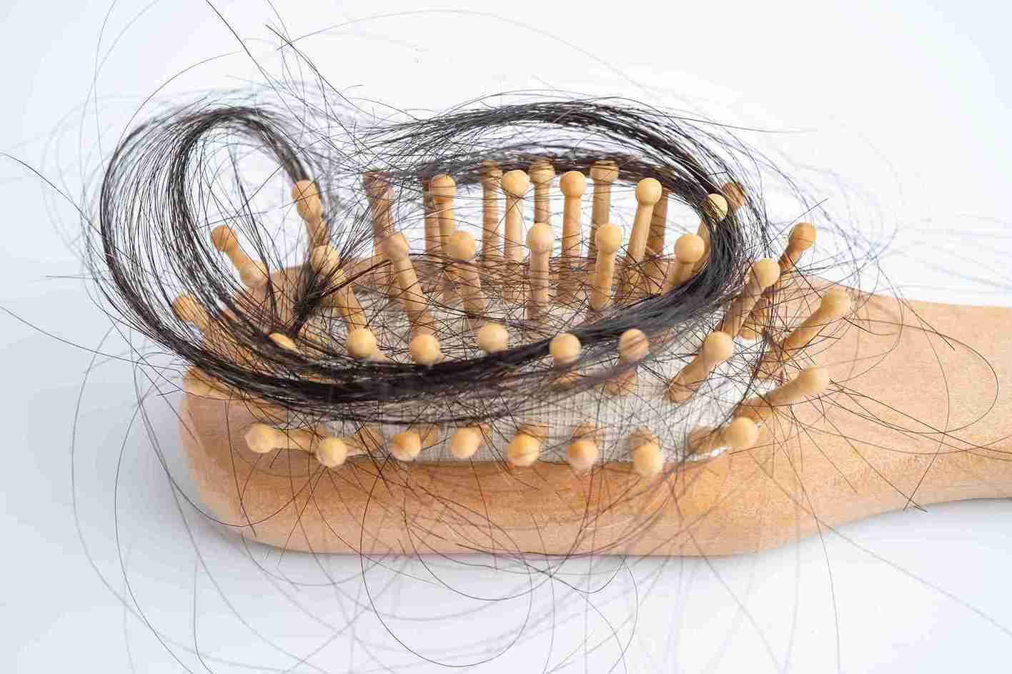 Eine Haarbürste mit vielen ausgefallenen Haaren, die sich zwischen den Holzborsten verfangen haben. Das Bild symbolisiert Haarausfall, wie er durch androgenetische Alopezie auftreten kann. Die Ludwig-Skale wird verwendet, um den Schweregrad dieses Haarausfalls bei Frauen zu klassifizieren.
