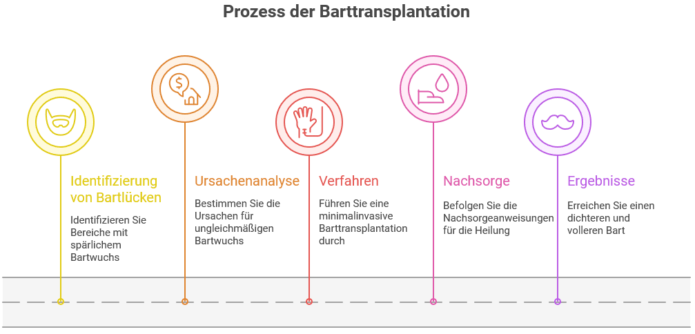 Grafik mit dem Titel „Prozess der Barttransplantation“, die fünf farblich markierte Schritte darstellt.