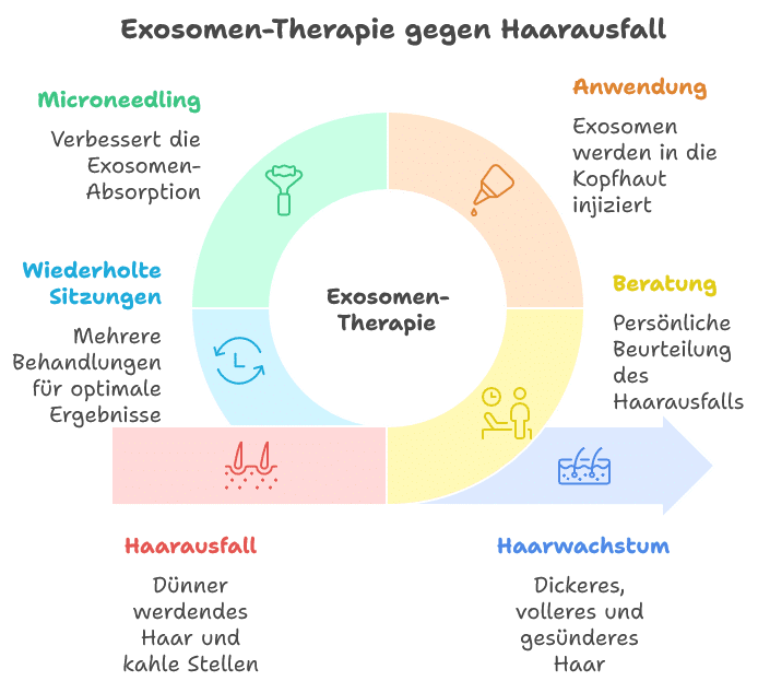 Infografik zur Exosomen-Therapie gegen Haarausfall: Darstellung von Beratung, Anwendung, Microneedling und wiederholten Sitzungen, die von Haarverlust zu stärkerem Haarwachstum führen.