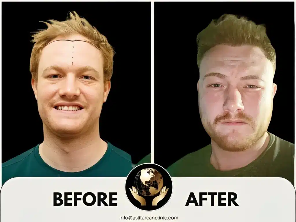 Before And After Transformation of Aaron Paul