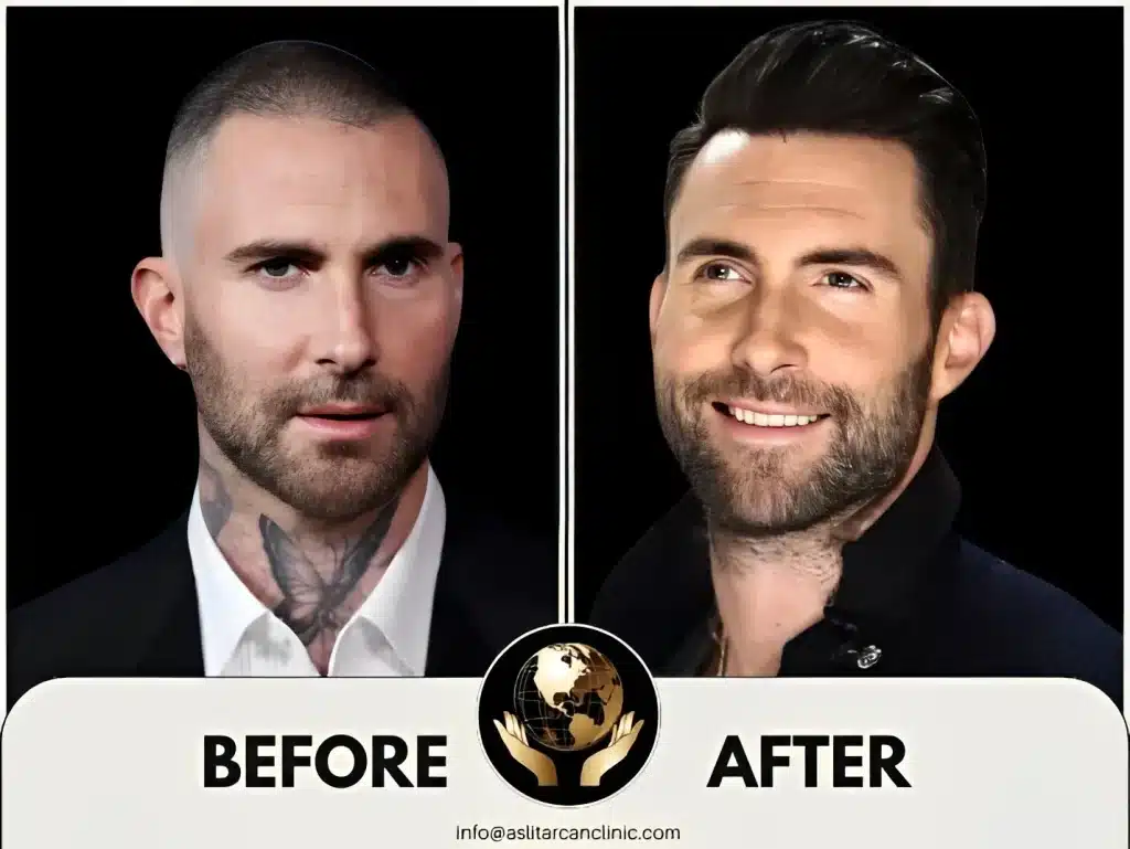 Before And After Transformation of Adam Levine