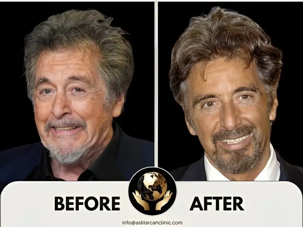 Before And After Transformation of Al Pacino