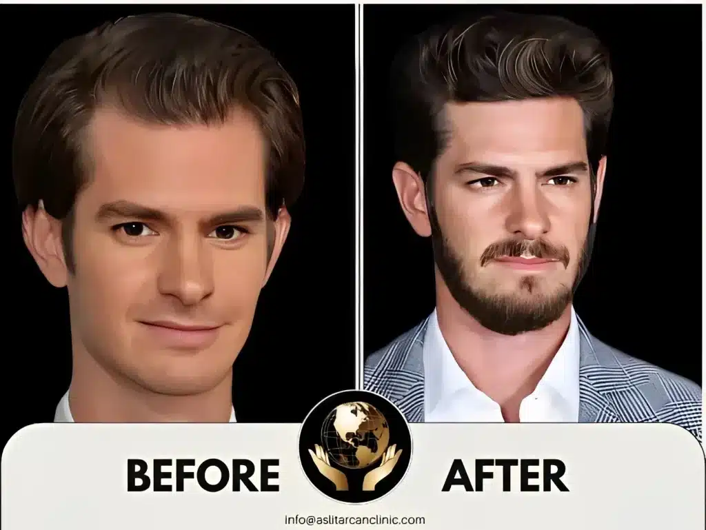Before And After Transformation of Andrew Garfield