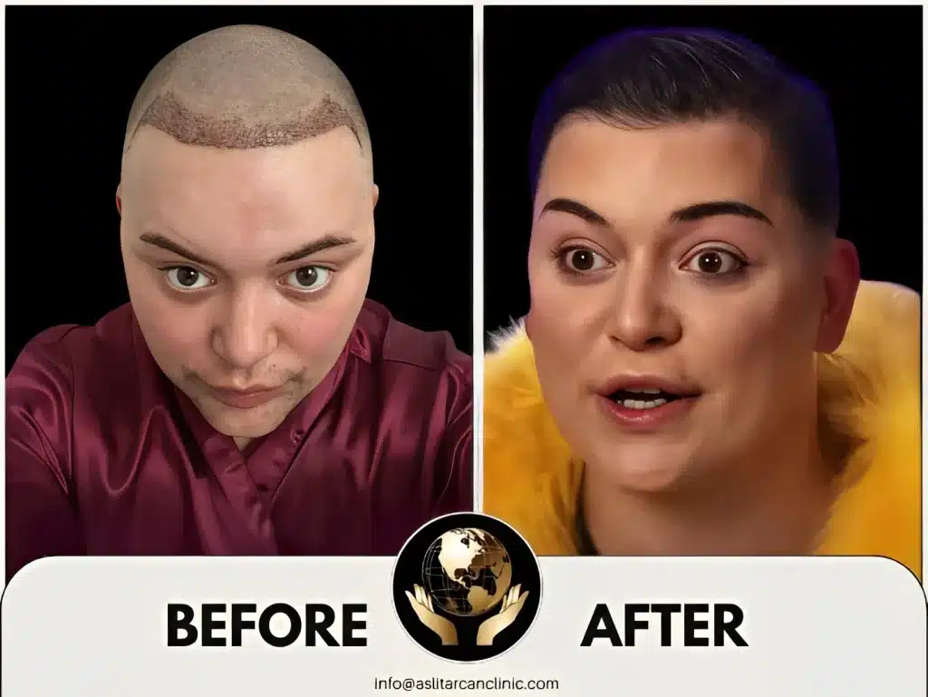 Before And After Transformation of Baga Chipz