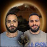 Before-and-After-hair-transplant-at-asli-tarcan-clinic