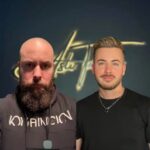 Before-and-after-hair-transplant