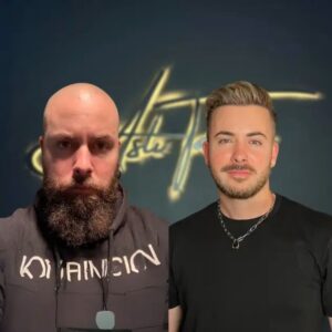 Before-and-after-hair-transplant