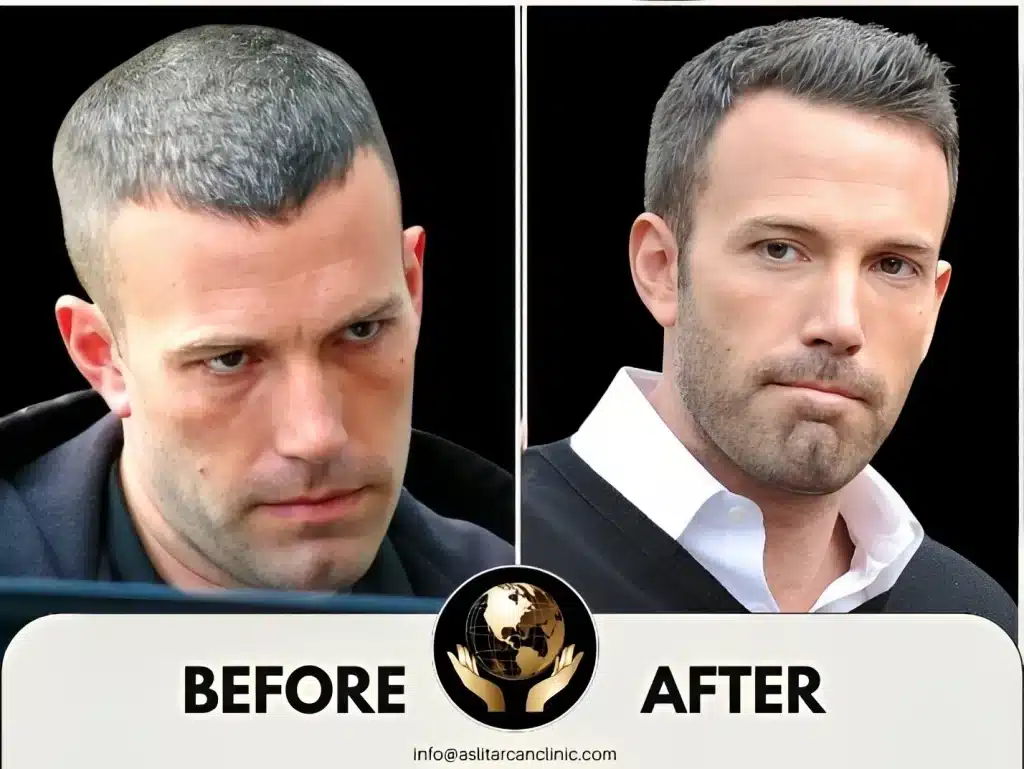 Before And After Transformation of Ben Affleck