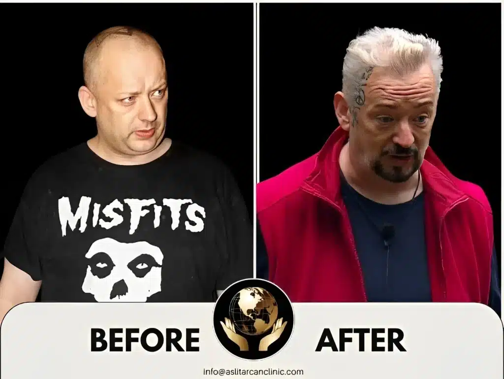 Before And After Transformation of Boy George