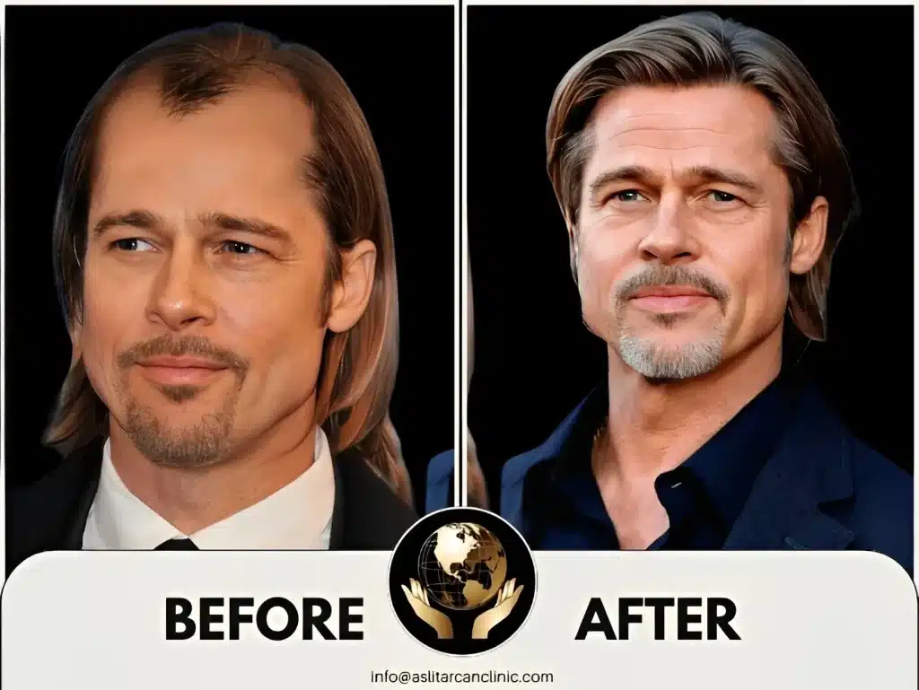 Before And After Transformation of Brad Pitt