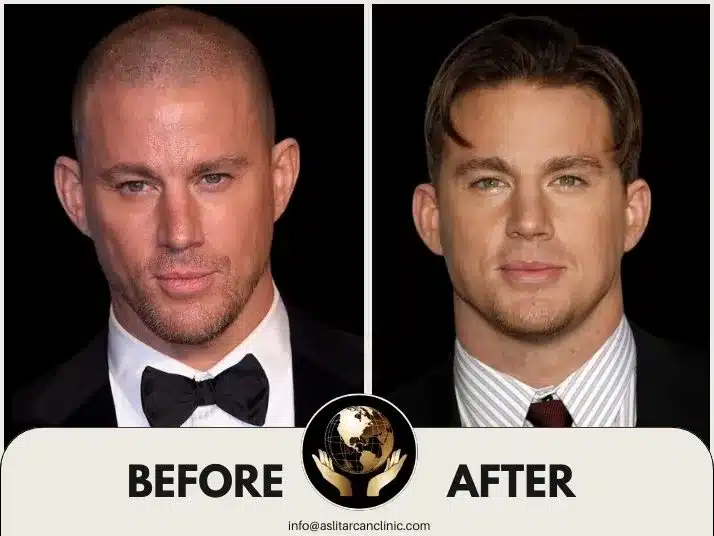 Before And After Transformation of Channing Tatum