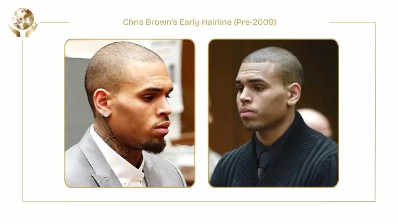 Two side-by-side images labeled ‘Chris Brown’s Early Hairline (Pre-2009)’ showing Chris Brown with a closely shaved hairstyle and a naturally higher, less defined hairline. Both photos capture him in profile and three-quarter views, highlighting his early hairline appearance before later changes.